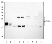 Western blot testing of 1) 20ng/lane recombinant protein, 2) 10ng/lane recombinant protein, 3) human U-87 MG, 4) human K562, 5) human U-251, 6) rat brain, 7) rat C6, 8) mouse brain and 9) mouse Neuro-2a cell lysate with VEGF antibody. Predicted molecular weight 19~22 kDa (monomer) and 38~44 kDa (dimer).
