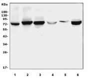 Western blot testing of 1) rat lung, 2) rat thymus, 3) rat spleen, 4) mouse lung, 5) mouse testis and 6) mouse thymus tissue lysate with ALOX15 antibody. Predicted molecular weight ~75 kDa.