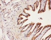 IHC-P: ALOX15 antibody testing of rat lung tissue