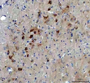 IHC-P staining of rat brain tissue with BDNF antibody. HIER: steam section in pH8 EDTA buffer for 20 min and allow to cool prior to staining.