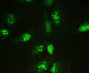 Immunofluorescent staining of FFPE human U-2 OS cells with Galectin 3 antibody at 2ug/ml. HIER: steam section in pH6 citrate buffer for 20 min.