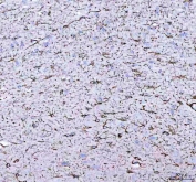 IHC staining of FFPE pig brain tissue with GFAP antibody. HIER: boil tissue sections in pH8 EDTA for 20 min and allow to cool before testing.