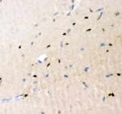 IHC staining of FFPE mouse brain tissue with Crk antibody. HIER: boil tissue sections in pH8 EDTA for 20 min and allow to cool before testing.