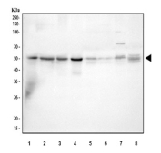 Western blot testing of 1) human MCF7, 2) human HepG2, 3) human Caco-2, 4) human 293T, 5) rat heart, 6) rat kidney, 7) mouse heart and 8) mouse kidney tissue lysate with AAMP antibody. Predicted molecular weight: ~47 kDa.