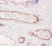 IHC-P: ACE antibody testing of human placenta tissue. HIER: boil tissue sections in pH6, 10mM citrate buffer, for 20 min and allow to cool before testing.