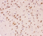 IHC-P staining of mouse brain tissue. HIER: steam section in pH6 citrate buffer for 20 min.