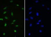 IF/ICC staining of FFPE human U-2 OS cells with APE1 antibody (green) at 2ug/ml and DAPI nuclear stain (blue). HIER: steam section in pH6 citrate buffer for 20 min.