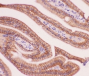 IHC testing of FFPE mouse intestine tissue with alpha Catenin antibody at 1ug/ml. Required HIER: steam section in pH6 citrate buffer for 20 min and allow to cool prior to staining.