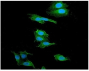 Immunofluorescent staining of FFPE human U-2 OS cells with alpha Catenin antibody (green) and DAPI nuclear stain (blue). HIER: steam section in pH6 citrate buffer for 20 min.