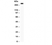 Western blot testing of MUC4 antibody and PC12 lysate