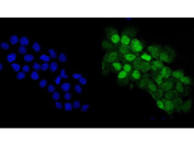 Immunofluorescent staining of FFPE human A431 cells with p63 antibody (green) and DAPI nuclear stain (blue). HIER: steam section in pH6 citrate buffer for 20 min.