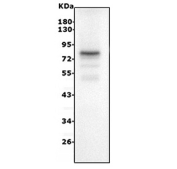 Western blot testing of human A431 cell lysate with p63 antibody. Predicted molecular weight: 47-77 kDa (multiple isoforms).