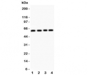 Western blot testing of RUNX2 antibody and Lane 1:  HeLa;  2: A431;  3: K562;  4: Jurkat.  Predicted molecular weight: 50-60 kDa.