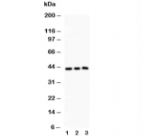 Western blot testing of SIRT2 antibody and Lane 1:  rat spleen;  2: HeLa;  3: A549