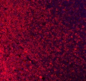 Immunofluorescent staining of FFPE human tonsil tissue with CD79a antibody (red) and DAPI nuclear stain (blue). HIER: boil tissue sections in pH8 EDTA for 20 min and allow to cool before testing.