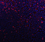 Immunofluorescent staining of FFPE human tonsil tissue with CD79b antibody (red) and DAPI nuclear stain (blue). HIER: steam section in pH8 EDTA buffer for 20 min.