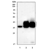 Western blot testing of human 1) Raji, 2) Daudi and 3) Ramos cell lysate with CD79b antibody. Expected molecular weight: 26-39 kDa depending on glycosylation level.