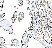 IHC staining of FFPE human placental tissue with C/EBP beta antibody. HIER: boil tissue sections in pH8 EDTA for 20 min and allow to cool before testing.