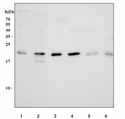 Western blot testing of 1) human HeLa, 2) human Jurkat, 3) rat liver, 4) rat kidney, 5) mouse liver and 6) mouse kidney tissue lysate with DHFR antibody. Predicted molecular weight: 16/21 kDa (two isoforms).