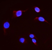 Immunofluorescent staining of FFPE human U-2 OS cells with DHFR antibody (red) and DAPI nuclear stain (blue). HIER: steam section in pH6 citrate buffer for 20 min.