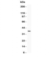 Western blot testing of Estrogen Receptor antibody and recombinant human protein (0.5ng)