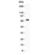 Western blot testing of Estrogen Receptor antibody and MCF-7 lysate (human breast tumor cell line).  Predicted molecular weight ~67 kDa.