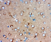 IHC staining of FFPE mouse brain tissue with GLUR1 antibody, HRP-secondary and DAB substrate. HIER: boil tissue sections in pH8 EDTA for 20 min and allow to cool before testing.