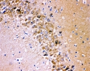 IHC staining of FFPE rat brain tissue with GLUR1 antibody, HRP-secondary and DAB substrate. HIER: boil tissue sections in pH8 EDTA for 20 min and allow to cool before testing.