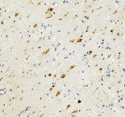IHC staining of FFPE human brain tissue with GLUR1 antibody, HRP-secondary and DAB substrate. HIER: boil tissue sections in pH8 EDTA for 20 min and allow to cool before testing.