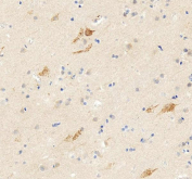 IHC staining of FFPE human brain tissue with GLUR1 antibody, HRP-secondary and DAB substrate. HIER: boil tissue sections in pH8 EDTA for 20 min and allow to cool before testing.