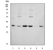 Western blot testing of 1) human Jurkat, 2) human HeLa, 3) human K562, 4) human PANC-1, 5) rat PC-12 and 6) mouse RAW264.7 cell lysate with Heme Oxygenase 2 antibody. Predicted molecular weight ~36 kDa.