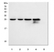 Western blot testing of human 1) A549, 2) Caco-2, 3) HeLa, 4) MCF7 and 5) HT-1080 cell lysate with HSP27 antibody.  Expected molecular weight: 23-27 kDa.