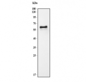 Western blot testing of mouse plasma lysate with Fetuin A antibody. Predicted molecular weight: 39-59 kDa depending on level of glycosylation.