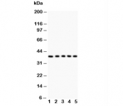 Western blot testing of Fas antibody and Lane 1:  HeLa;  2: Jurkat;  3: A549;  4: SMMC-7721;  5: K562 lysate. Predicted molecular weight: ~38 kDa (unmodified), 40-55 kDa (glycosylated).