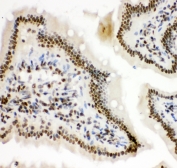 IHC-P: HIF-1 alpha antibody testing of mouse intestine tissue
