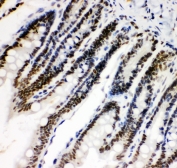 IHC-P: HIF-1 alpha antibody testing of rat intestine tissue