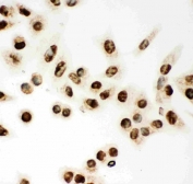 Immunocytochemical staining of FFPE human A549 cells with MCM7 antibody. HIER: steam section in pH6 citrate buffer for 20 min.