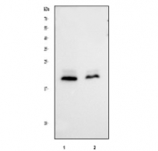 Western blot testing of human 1) Jurkat and 2) MDA-MB-453 cell lysate with MGMT antibody.  Predicted molecular weight: ~23 kDa.