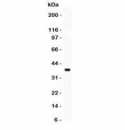 Western blot testing of TRP7 antibody and recombinant human protein (0.5ng)
