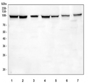Western blot testing of 1) human K562, 2) human SH-SY5Y, 3) human HEL, 4) human 293T, 5) human A549, 6) rat PC-12 and 7) mouse Neuro-2a cell lysate with MSH2 antibody. Expected molecular weight: ~105 kDa.