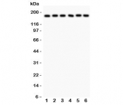 Western blot testing of PAPP-A antibody and human samples 1:  placenta;  2: HT1080;  3: SKOV;  4: 22RV1;  5: SW620;  6: MM231 lysate.  Predicted/observed size ~180KD