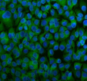 Immunofluorescent staining of FFPE human SK-O-V3 cells with DJ-1 antibody (green) and DAPI nuclear stain (blue). HIER: steam section in pH6 citrate buffer for 20 min.