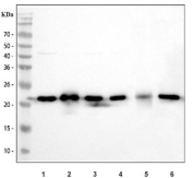 Western blot testing 1) human 293T, 2) human PANC-1, 3) human HeLa, 4) human U-251, 5) rat kidney and 6) mouse kidney tissue lysate with DJ-1 antibody.  Predicted molecular weight ~20 kDa.
