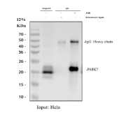 Immunoprecipitation of DJ-1 protein from 500ug of human HeLa whole cell lysate with 2ug of DJ-1 antibody.
