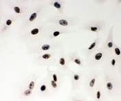 ICC testing of PARP antibody and human A549 cells.