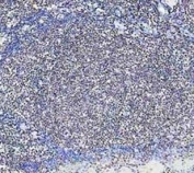 IHC staining of FFPE human tonsil tissue with PARP antibody. HIER: boil tissue sections in pH8 EDTA for 20 min and allow to cool before testing.