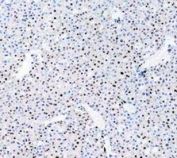 IHC staining of FFPE mouse liver tissue with PARP antibody. HIER: boil tissue sections in pH8 EDTA for 20 min and allow to cool before testing.