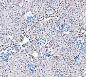 IHC staining of FFPE mouse kidney tissue with PARP antibody. HIER: boil tissue sections in pH8 EDTA for 20 min and allow to cool before testing.