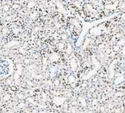 IHC staining of FFPE rat kidney tissue with PARP antibody. HIER: boil tissue sections in pH8 EDTA for 20 min and allow to cool before testing.