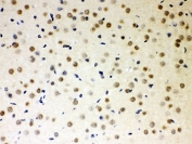 IHC-P: PKC iota antibody testing of rat brain tissue